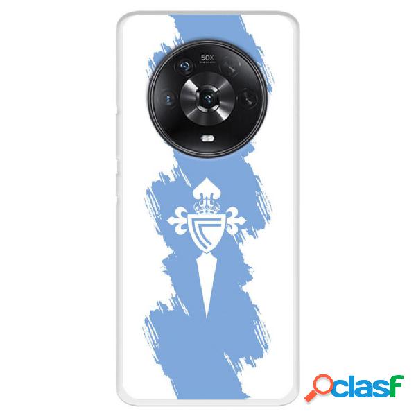 Funda Para Huawei Honor Magic4 Lite Del Rc Celta Escudo